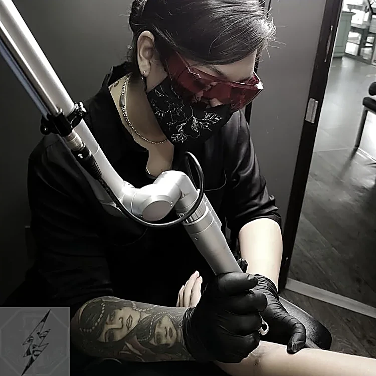 Olga, con lentes de protección, hace una sesión de remoción láser en un brazo